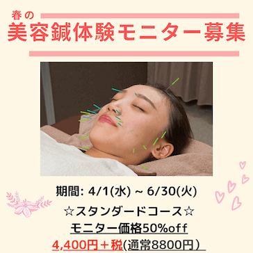 美容鍼モニター募集