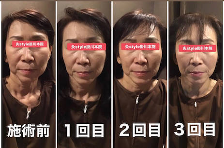 50代の美容ケア