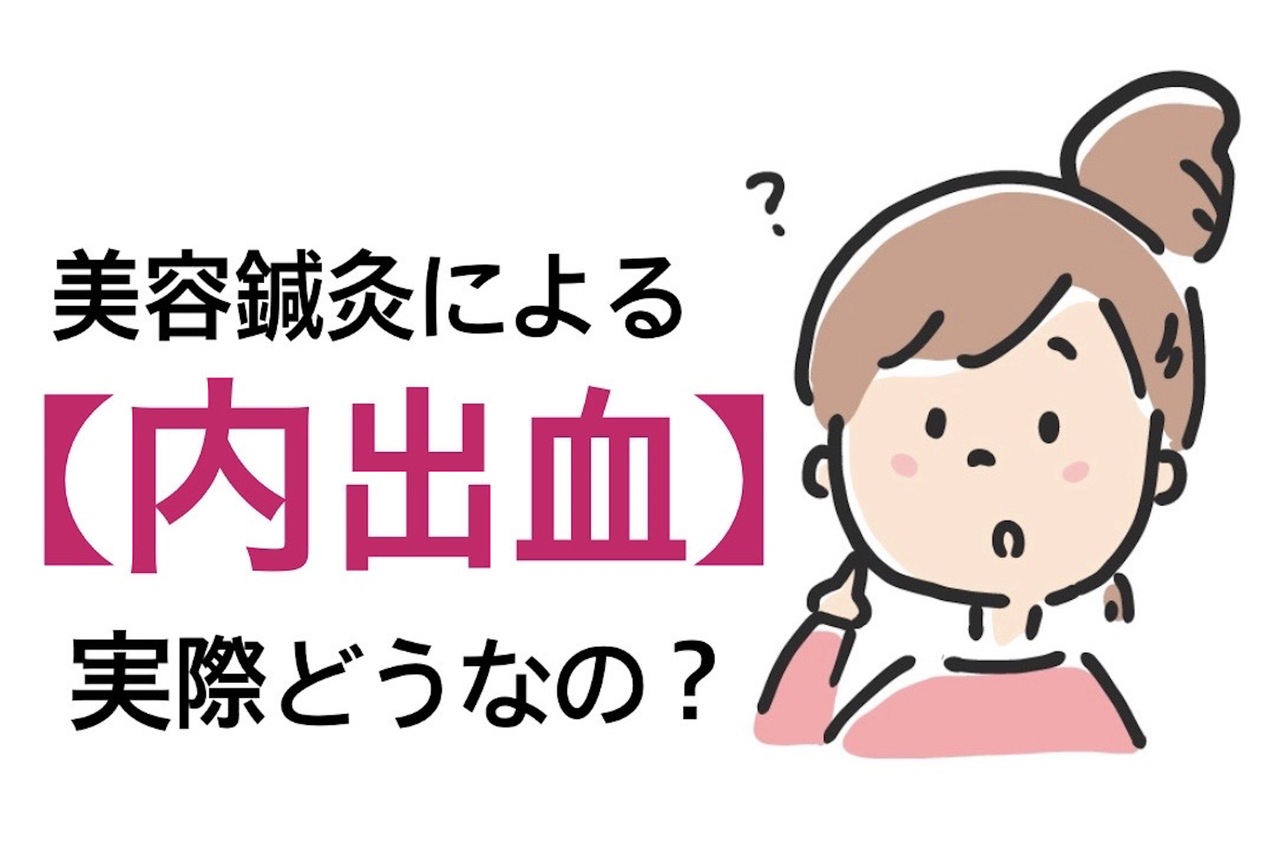 美容鍼による内出血のリスク