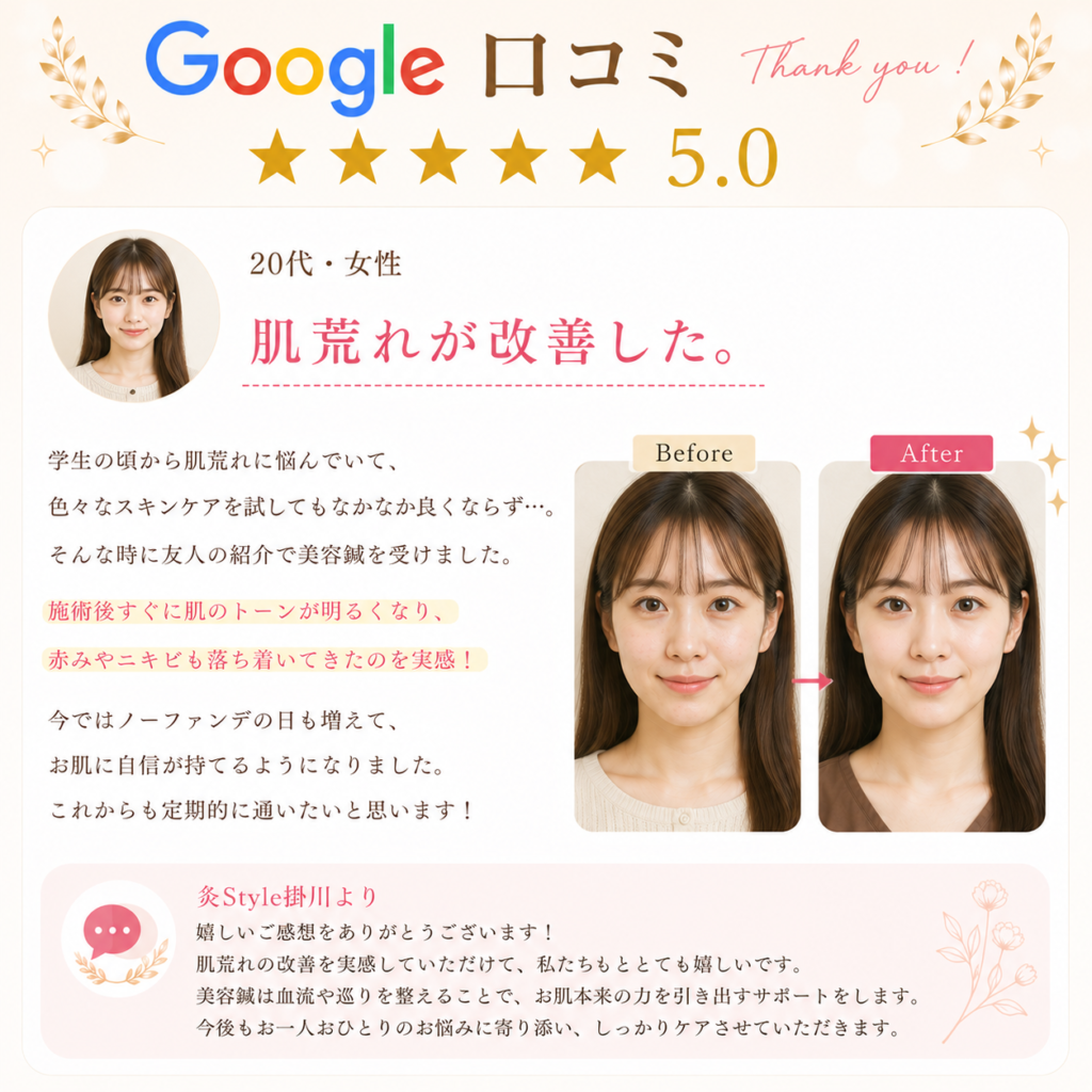 Google口コミ
★★★★★5.0
20代女性
肌荒れが改善した。
学生の頃から肌荒れに悩んでいて、色々なスキンケアを試してもなかなか良くならず、、、
そんな時に友人の紹介で美容鍼を受けました。
施術後すぐに肌のトーンが明るくなり、赤みニキビも落ち着いてきたのを実感！
今ではノーファンデの日も増えて、
お肌に自信が持てるようになりました。
これからも定期的に通いたいと思います！