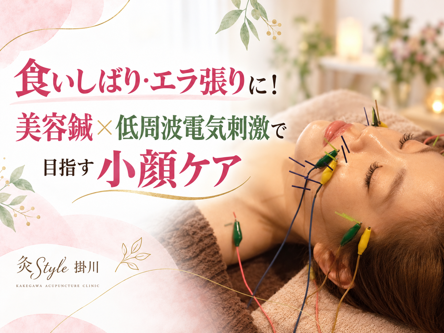 食いしばり・エラ張りに!美容鍼×低周波で目指す小顔ケア