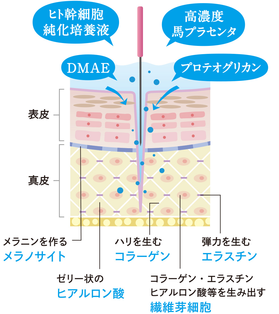 図解